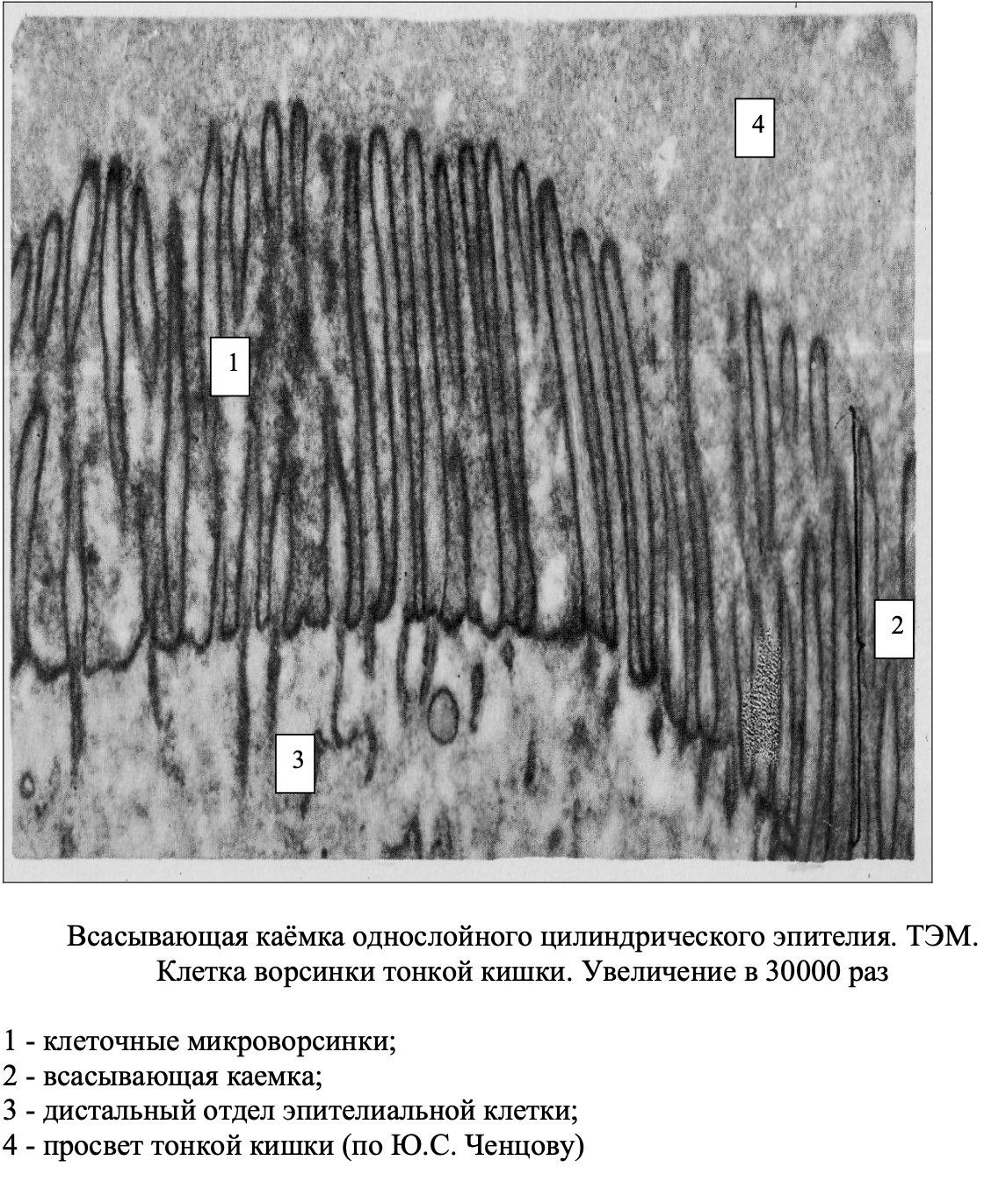 Всасывающая каёмка однослойного цилиндрического эпителия. Клетка ворсинки тонкой кишки