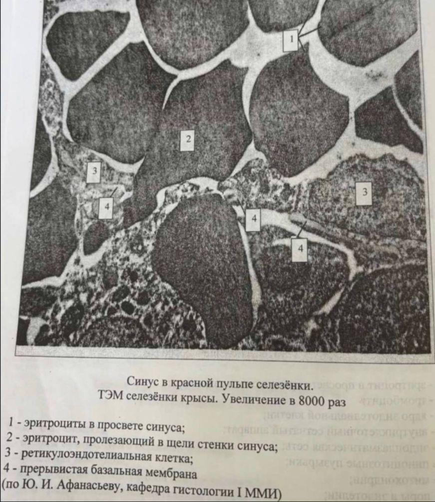 Синус в красной пульпе селезёнки