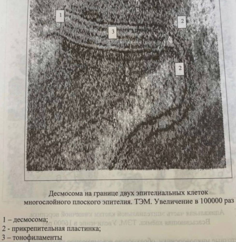 Десмосома на границе двух эпителиальных клеток многослойного плоского эпителия