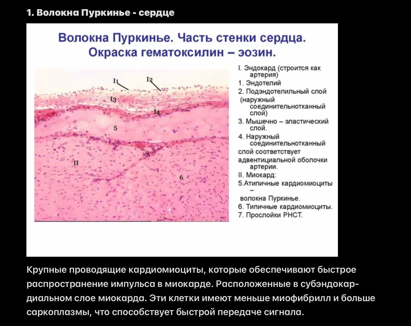 Волокна Пуркинье