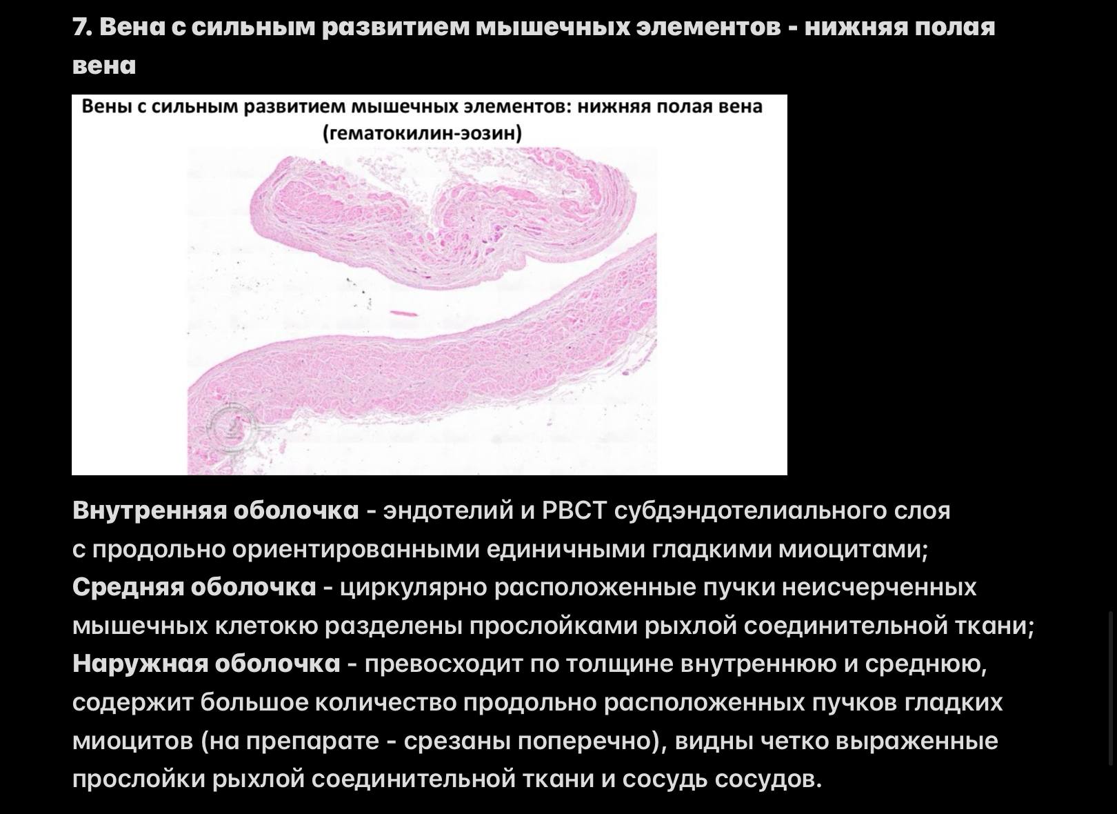 Нижняя полая вена