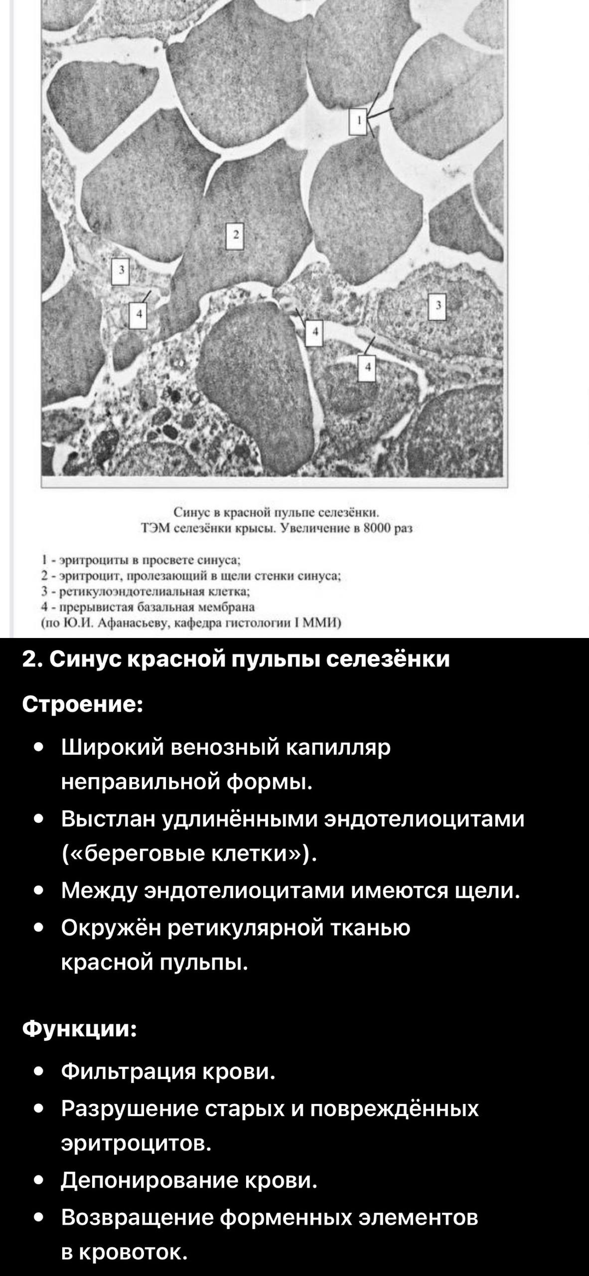 ТЭМ синуса красной пульпы селезёнки