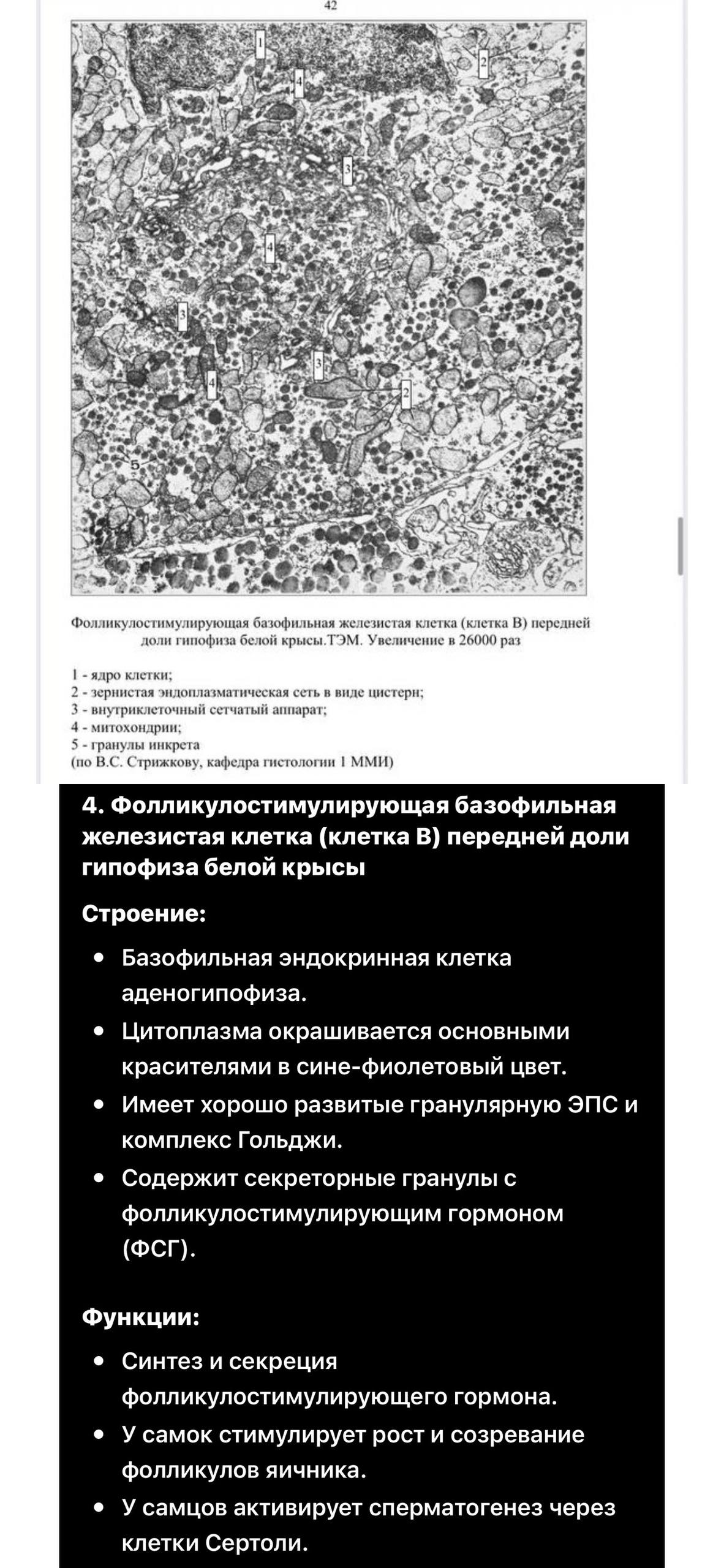 ТЭМ базофильной ФСГ-клетки гипофиза