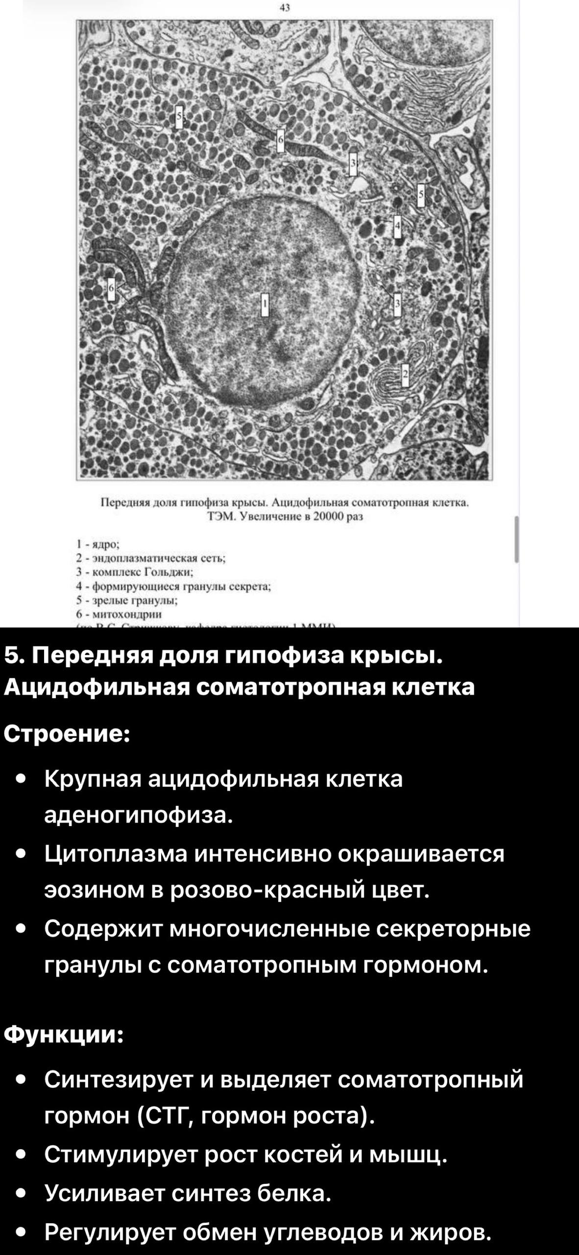 ТЭМ соматотропной клетки гипофиза