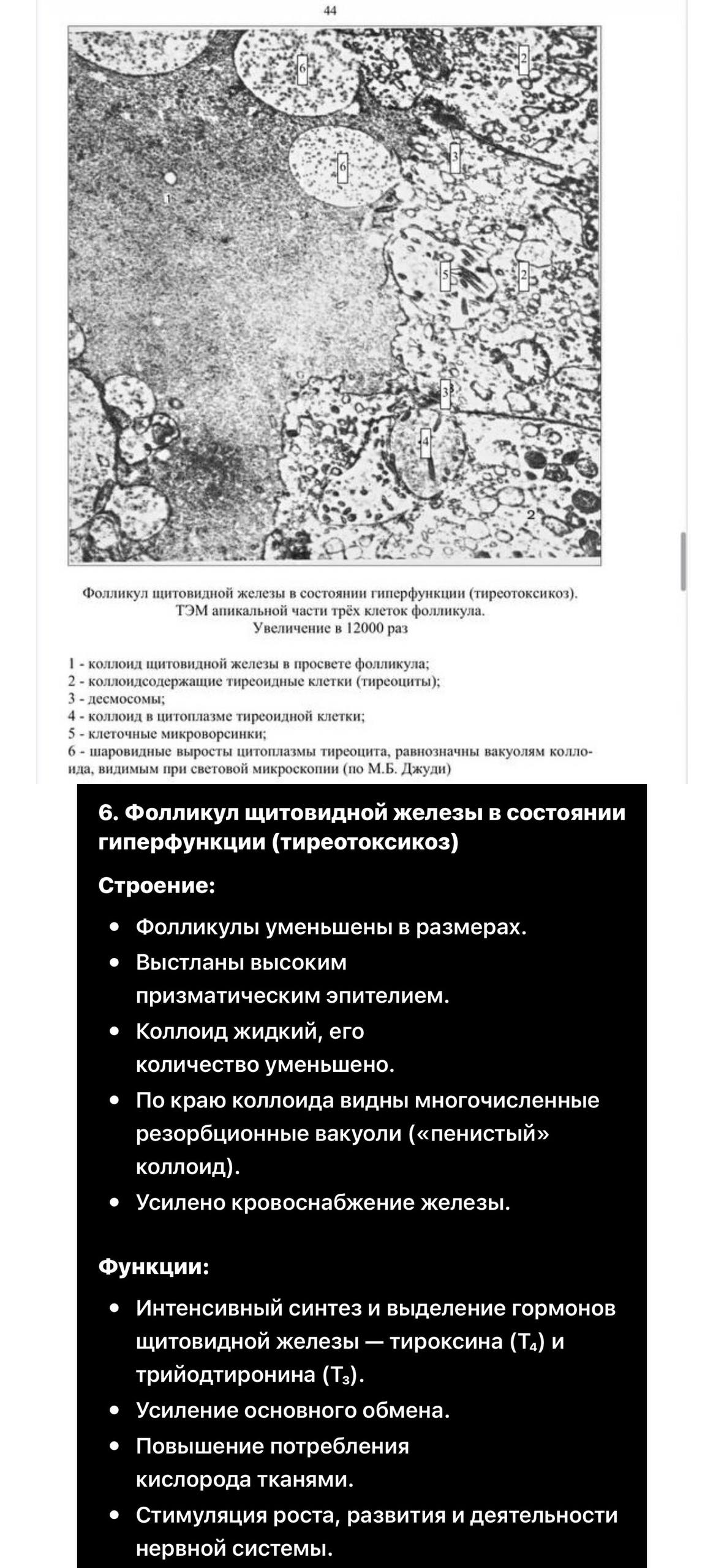 ТЭМ фолликула щитовидной железы при гиперфункции