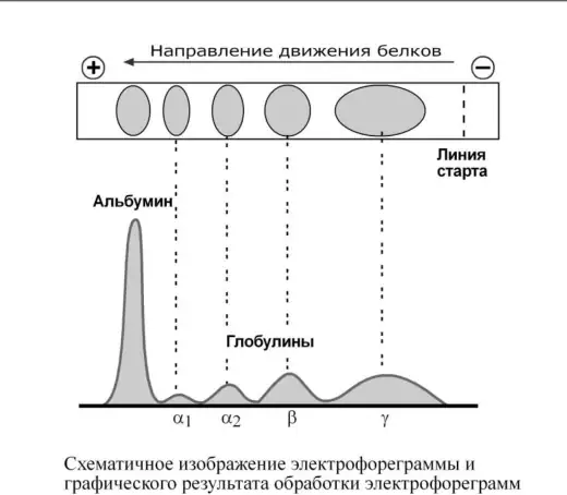 Разделение альбумина и глобулинов при электрофорезе