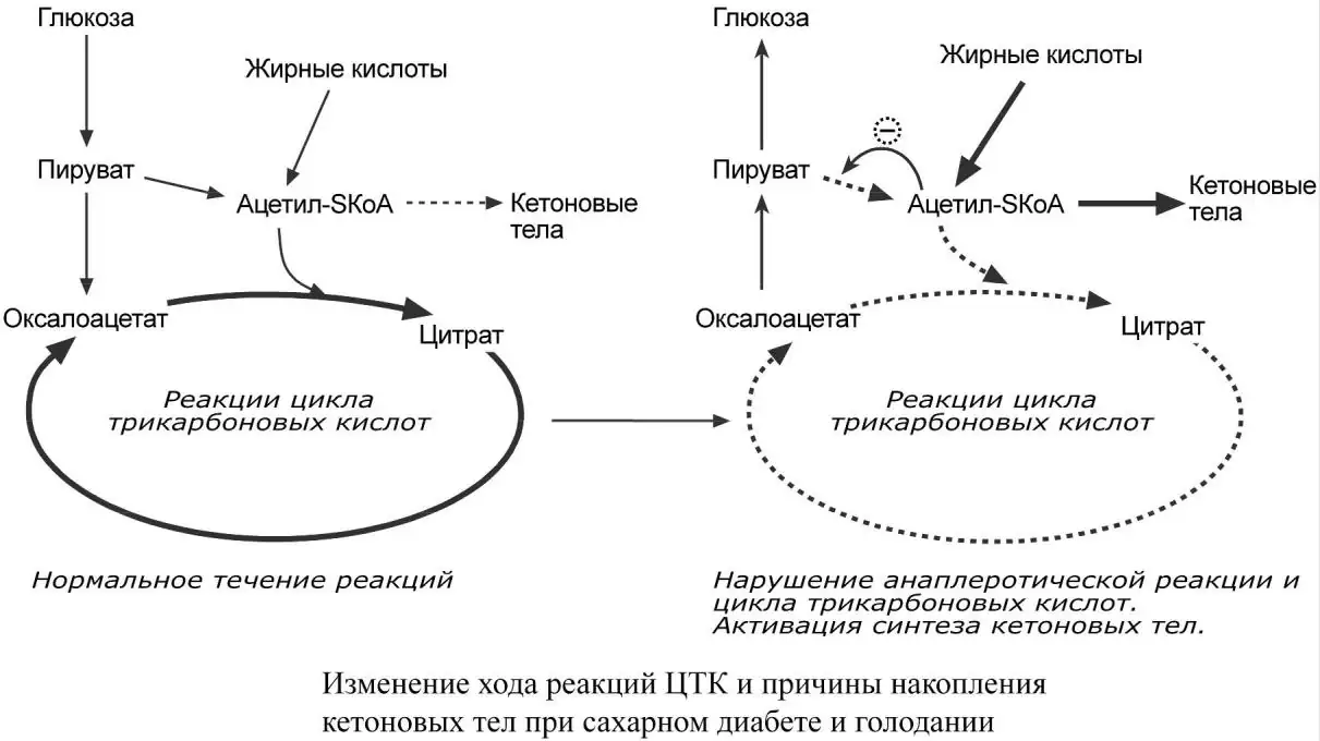Нарушение цикла трикарбоновых кислот и образование кетоновых тел