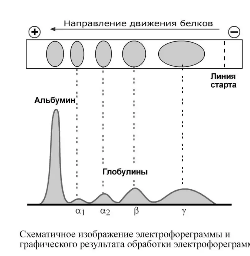 Схематическое изображение электрофореграммы белков плазмы