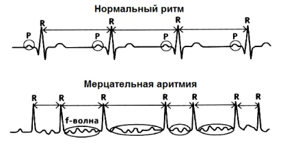 Иллюстрация к ответу