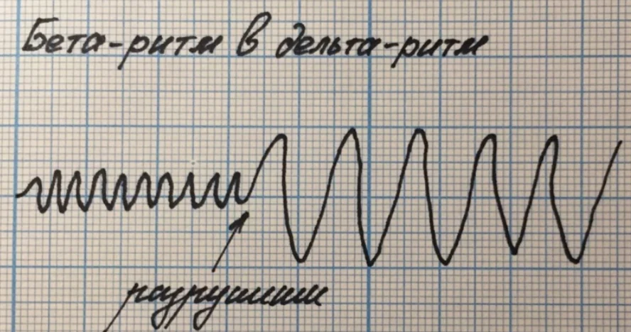 Иллюстрация к ответу